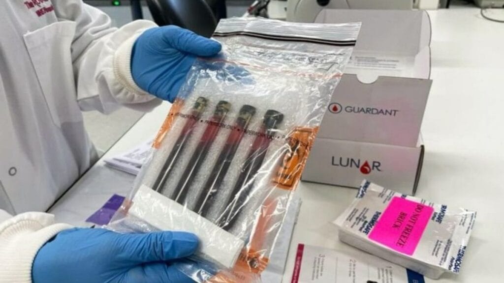 Yeni bir kan testi bağırsak kanseri hastalarını kemoterapiden kurtarabilir