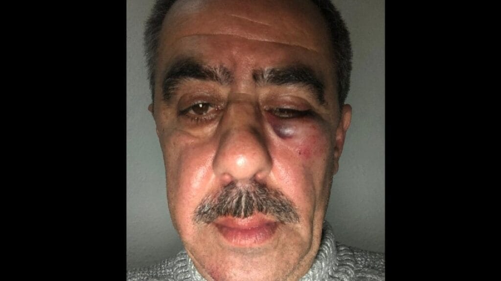 AKP’li başkanlar İYİ Parti’li müşahidi hastanelik etti